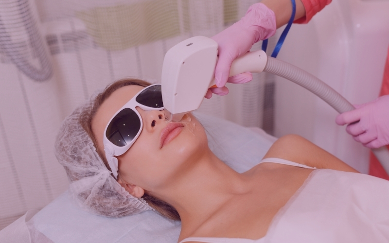 Laser treatment placeholder